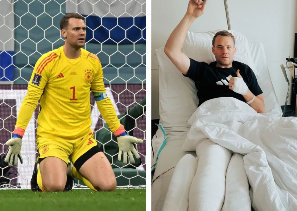 Manuel Neuer złamał nogę w czasie jazdy na nartach i będzie pauzował do końca sezonu Manuel Neuer złamał nogę w czasie jazdy na nartach i będzie pauzował do końca sezonu