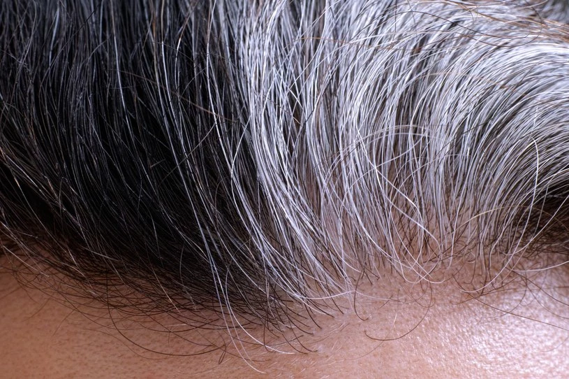 Niewłaściwa pielęgnacja i produkty do włosów z substancjami chemicznymi mogą sprawić, że zaczną one szybciej siwieć