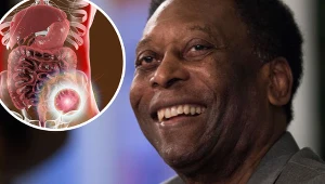 Raka wykryto u niego rok temu. Choroba rozwija się bardzo szybko