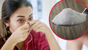 Wągry nie są wyłącznie problemem natury estetycznej. Niektóre z nich mogą się przekształcić w wykwity grudkowo-krostkowe lub torbiele ropne