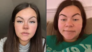 Nos kobiety w trakcie ciąży powiększył swój rozmiar, a dodatkowo stał się bolesny w dotyku /screen Tik Tok/alexjoelenejacobson