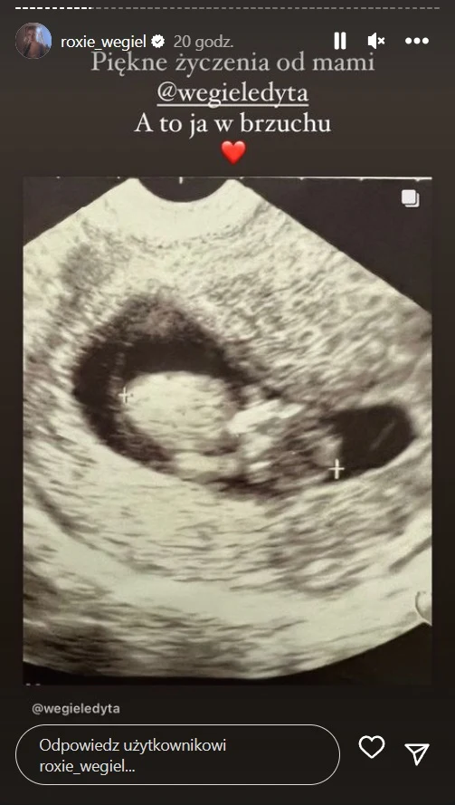 Roksana Węgiel pokazała w sieci zdjęcie z USG.... Roksana Węgiel pokazała w sieci zdjęcie z USG....