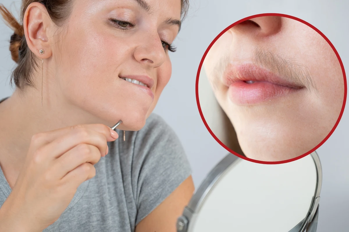 Nie wyrywaj tylko idź do lekarza. Sprawdź, kiedy nadmierne włoski to objaw choroby Nie wyrywaj tylko idź do lekarza. Sprawdź, kiedy nadmierne włoski to objaw choroby