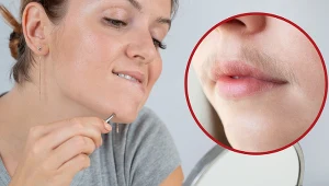 Nie wyrywaj tylko idź do lekarza. Sprawdź, kiedy nadmierne włoski to objaw choroby