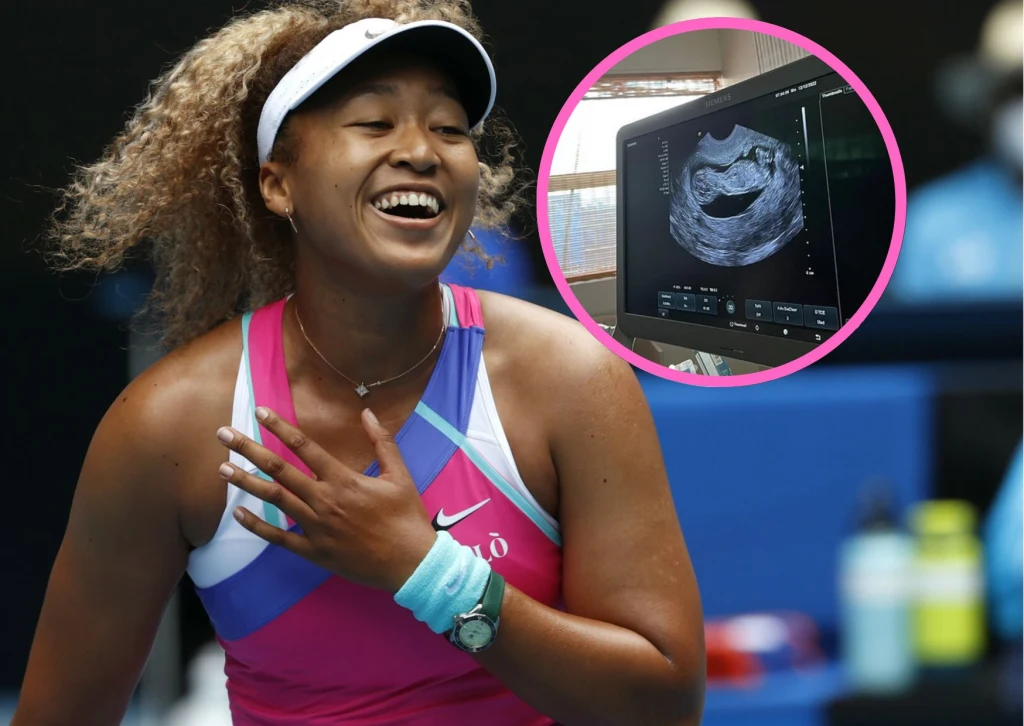 Naomi Osaka