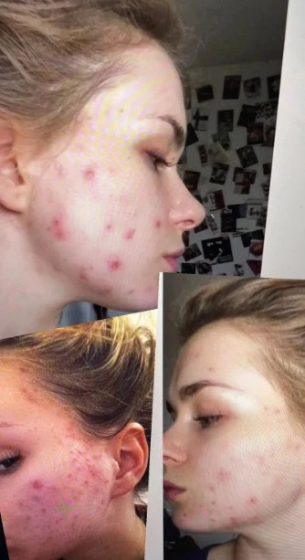 Zdjęcia udostępnione przez aktorkę w sieci. Zdjęcia udostępnione przez aktorkę w sieci.