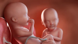 Mamy spodziewające się bliźniąt muszą wiedzieć o tym powikłaniu
