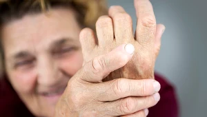 Reumatoidalne zapalenie stawów (RZS), choć w nazwie ma wyłącznie stawy, dotyczy całego organizmu