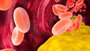 Jak zwiększyć poziom "dobrego" cholesterolu? Proste sposoby