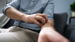 Dotyczy skóry i może być objawem nowotworu. Reaguj, kiedy tylko się pojawi