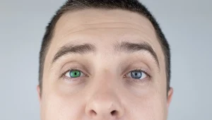 Jedno oko jest niebieskie, a drugie np. zielone? Może to być objaw choroby