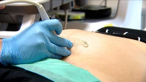 W przychodni zmarła kobieta w 5. miesiącu ciąży