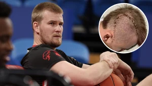 Harrison "Harry" Froling przeszedł operację głowy po tym, jak został napadnięty 22 stycznia