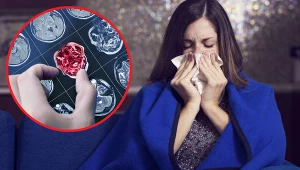 Wirus grypy lub wirus EBV mogą prowadzić do rozwoju choroby Alzheimera, Parskinsona a nawet stwardnienia rozsianego