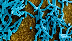 Ognisko śmiertelnego wirusa Marburg wykryto w Gwinei Równikowej. WHO zareagowała