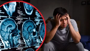 Choroba Alzheimera dotyka również młodych, osoby w wieku 30, 40 lat, a nawet młodsze. Wcześniej najmłodszą osobą z alzheimerem był 21-latek