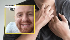 U Harry'ego Simpsona zdiagnozowano ostrą białaczkę limfoblastyczną. Pierwszym objawem, jaki zaobserwował, była wysypka