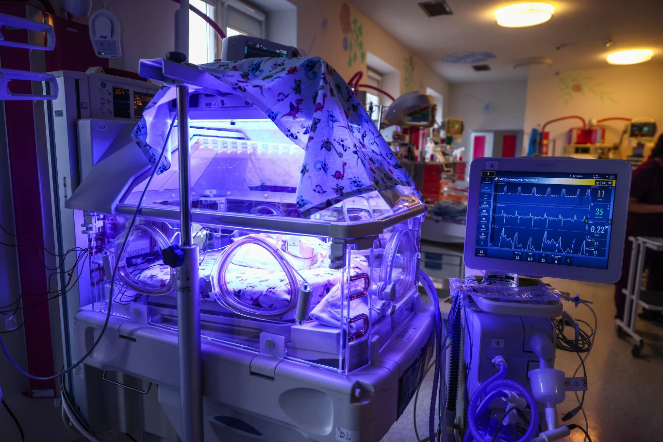 Nie żyje jeden z pięcioraczków urodzonych w Szpitalu Uniwersyteckim w Krakowie Nie żyje jeden z pięcioraczków urodzonych w Szpitalu Uniwersyteckim w Krakowie