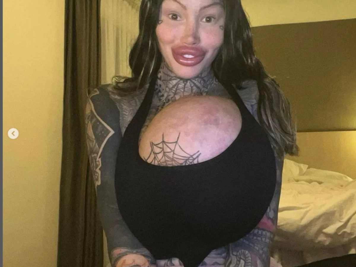 Wybuchł jej implant piersi ważący... 10 kg! Teraz żałuje: "Moje ciało nie dało rady! Wybuchł jej implant piersi ważący... 10 kg! Teraz żałuje: "Moje ciało nie dało rady!