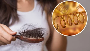 Nadmierne wypadanie włosów może oznaczać, że doszło do zarażenia chorobą weneryczną, jaką jest kiła