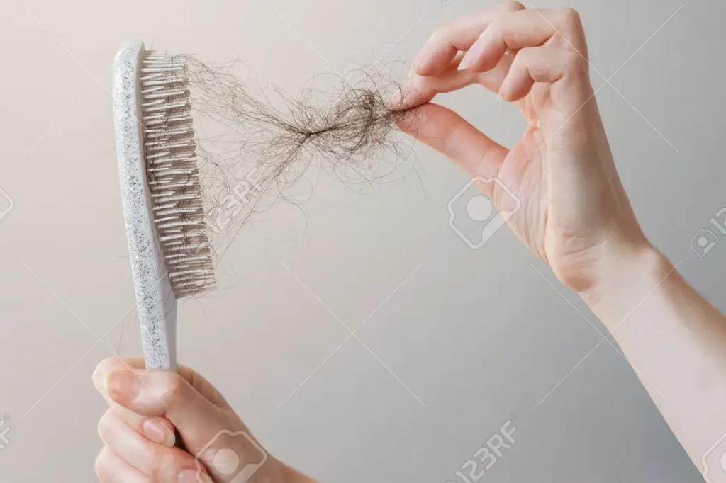 Infekcje przebiegające z wysoką gorączką mogą spowodować, że nawet kilka miesięcy po chorobie nadmiernie zaczynają wypadać włosy