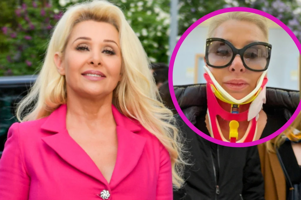 Aldona Orman miała wypadek na planie/instagram @aldona_orman