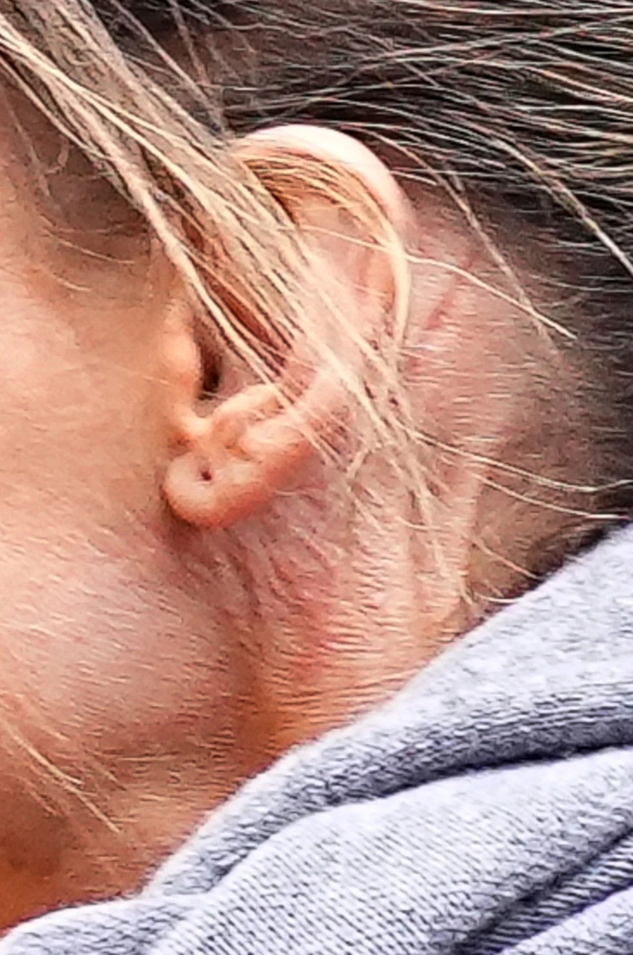 Małgorzata Rozenek z tajemniczym szwem za uchem