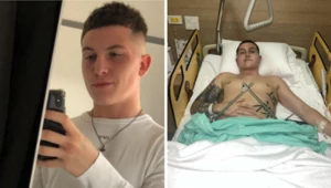 Kieran Martin, który przed wypadkiem był trenerem personalnym, po upadku z hotelowego balkonu w Tajlandii potrzebował operacji ratującej życie