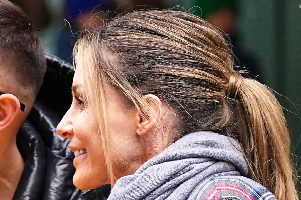 Małgorzata Rozenek ze szwem za uchem i balonikami mknie do niebieskiej Skody