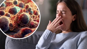 Objawem chłoniaka u 18-letniej uczennicy było nieustanne ziewanie oraz nadmierna senność