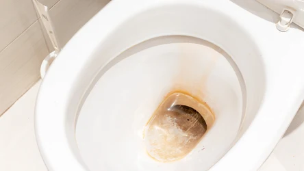 Jeśli z twojej toalety brzydko pachnie, z pomocą przyjdą ci drożdże oraz cukier