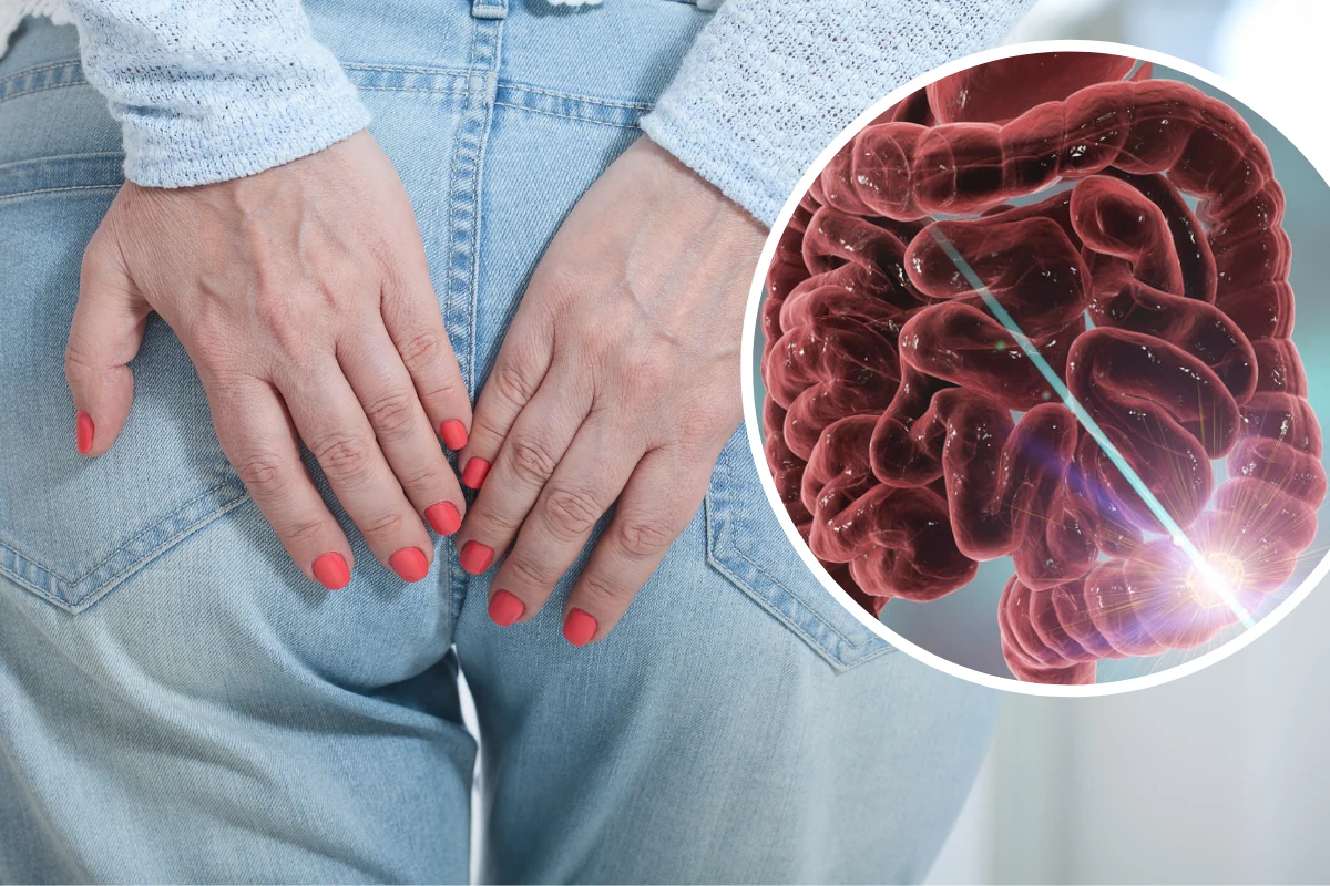 Zanim zaczniesz poszukiwać maści bez recepty i smarować podrażnione miejsca, idź do lekarza. Swędzenie może być objawem problem gastrologicznych