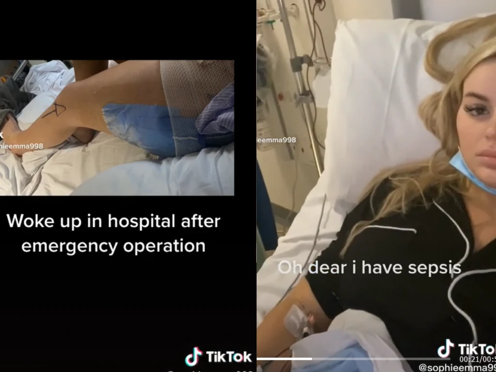 Sophie Dewey zrobiła lifting pośladków i prawi umarła. Przestrzega inne kobiety