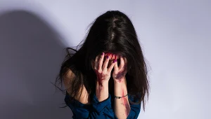 Ofiara przemocy, zdj. ilustracyjne