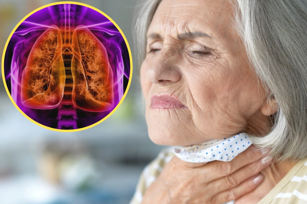 Nietypowym objawem zapalenia płuc może być niewielki stan podgorączkowy, nudności i ból gardła