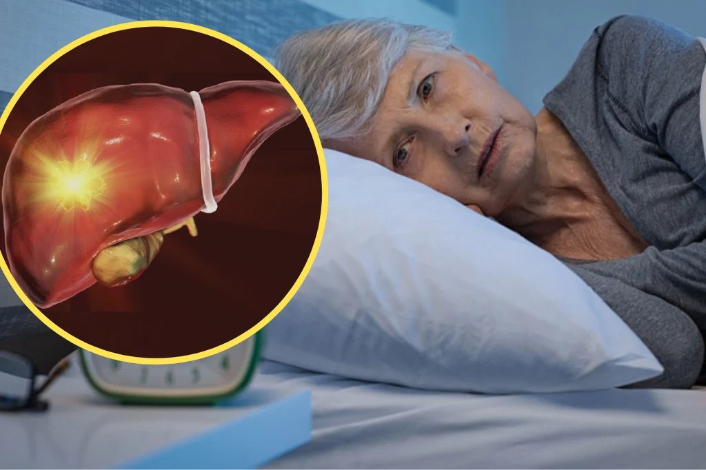 O problemach z wątrobą mogą świadczyć problemy ze snem O problemach z wątrobą mogą świadczyć problemy ze snem