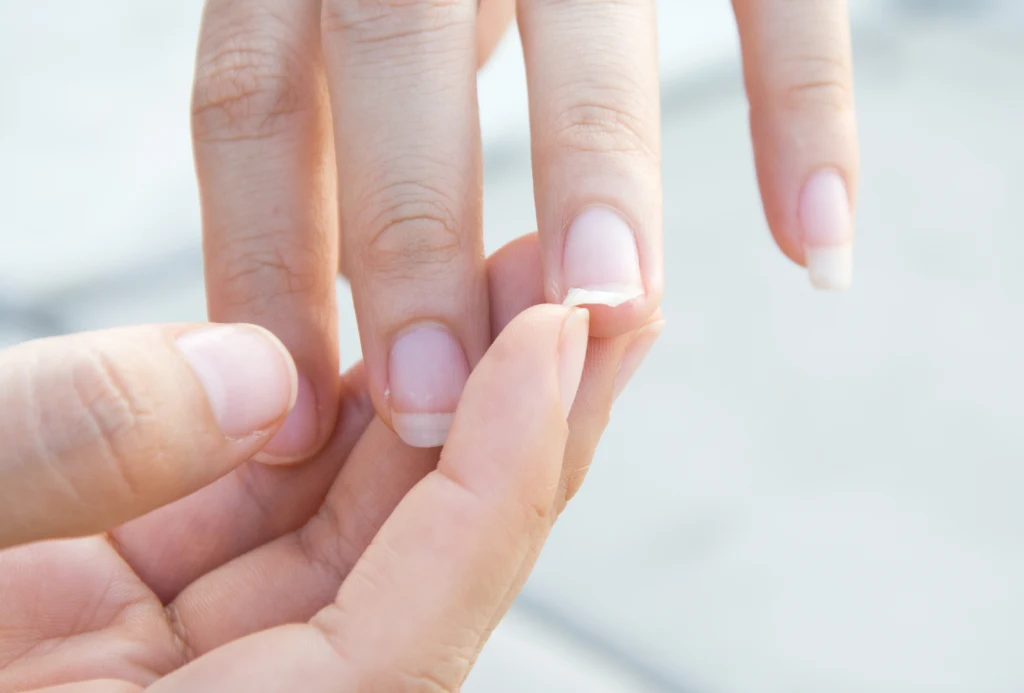 Paznokcie są kruche, łamliwe, matowe? To może być niedoczynność tarczycy