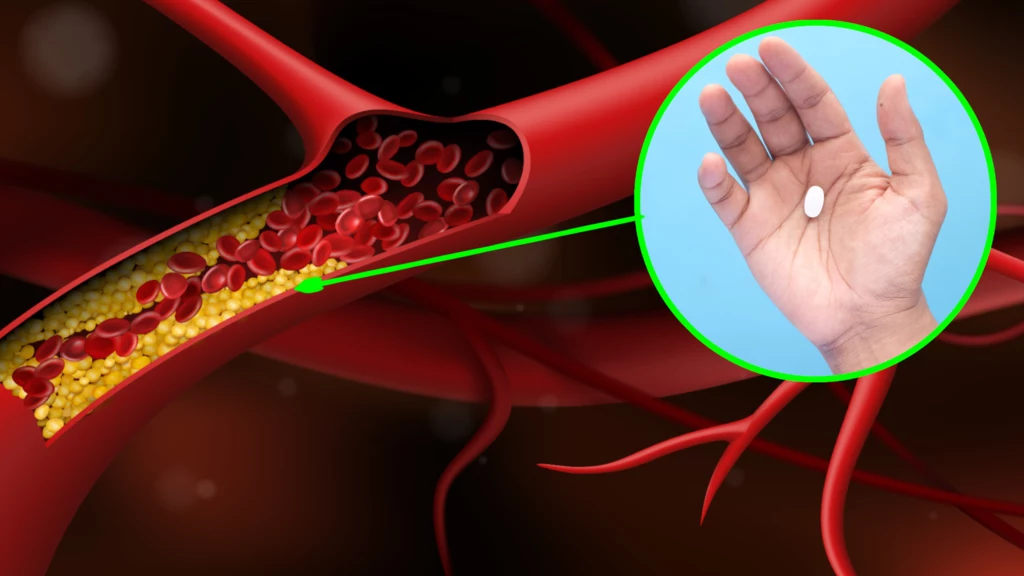 Naukowcy stworzyli nowy sposób zbijania cholesterolu. Wszystko zrobi jedna tabletka