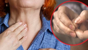 Choroby tarczycy mogą objawiać się na paznokciach. Na jakie zmiany warto zwrócić uwagę?