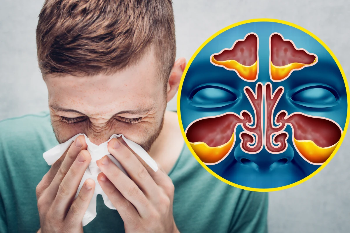 Choroba zatok tzutuje na wzrok, uszy i mózg. Problem mylimy z katarem lub alergią