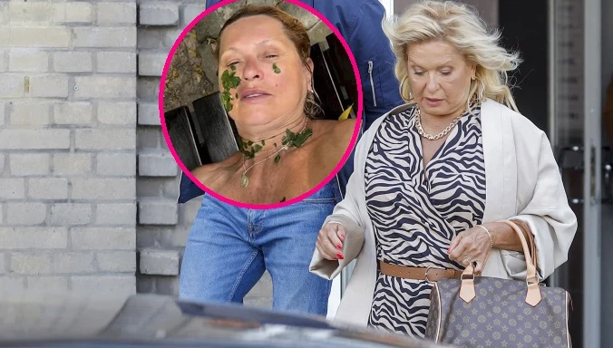 Ewa Kasprzyk ucierpiała po "ataku" meduzy Ewa Kasprzyk ucierpiała po "ataku" meduzy