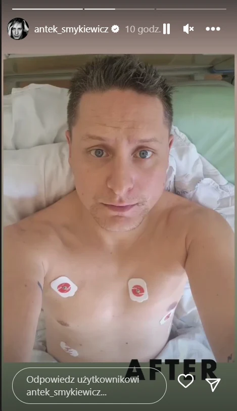 Antek Smykiewicz na zdjęciu po operacji
