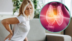 Przewlekły nadmiar hormonów tarczycy w organizmie nasila resorpcję składników mineralnych kości, prowadząc do ich nadmiernej kruchości