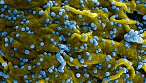 Wirus Marburg - zabójcza gorączka rozprzestrzenia się w Tanzanii