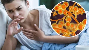 Początkowo zakażenie Candida auris niczym nie różni się od zwykłej infekcji, u chorych występuje gorączka oraz ból gardła