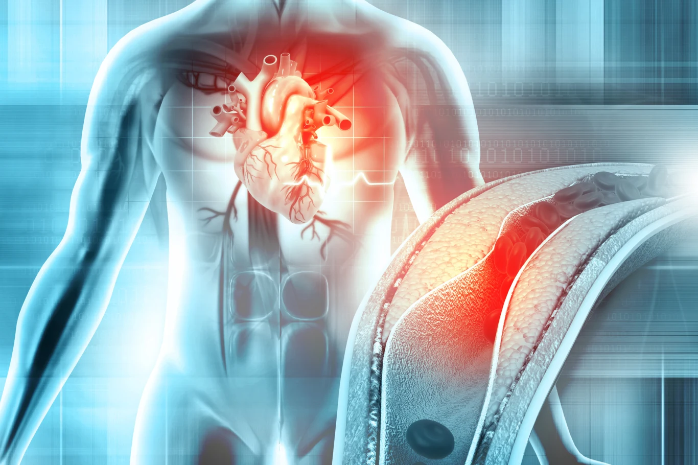 eptydy natriuretyczne są pojedynczą najważniejszą zmienną prognostyczną u pacjentów z niewydolnością serca. Osoby z otyłością mają ich wiekszy poziom eptydy natriuretyczne są pojedynczą najważniejszą zmienną prognostyczną u pacjentów z niewydolnością serca. Osoby z otyłością mają ich wiekszy poziom