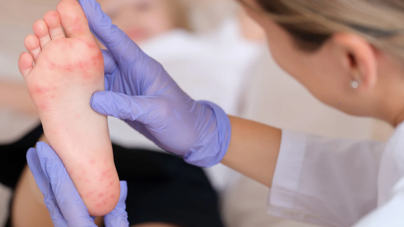 Bostonka to choroba, która najbardziej zakaźna jest u dzieci, jednak może również występować u dorosłych Bostonka to choroba, która najbardziej zakaźna jest u dzieci, jednak może również występować u dorosłych