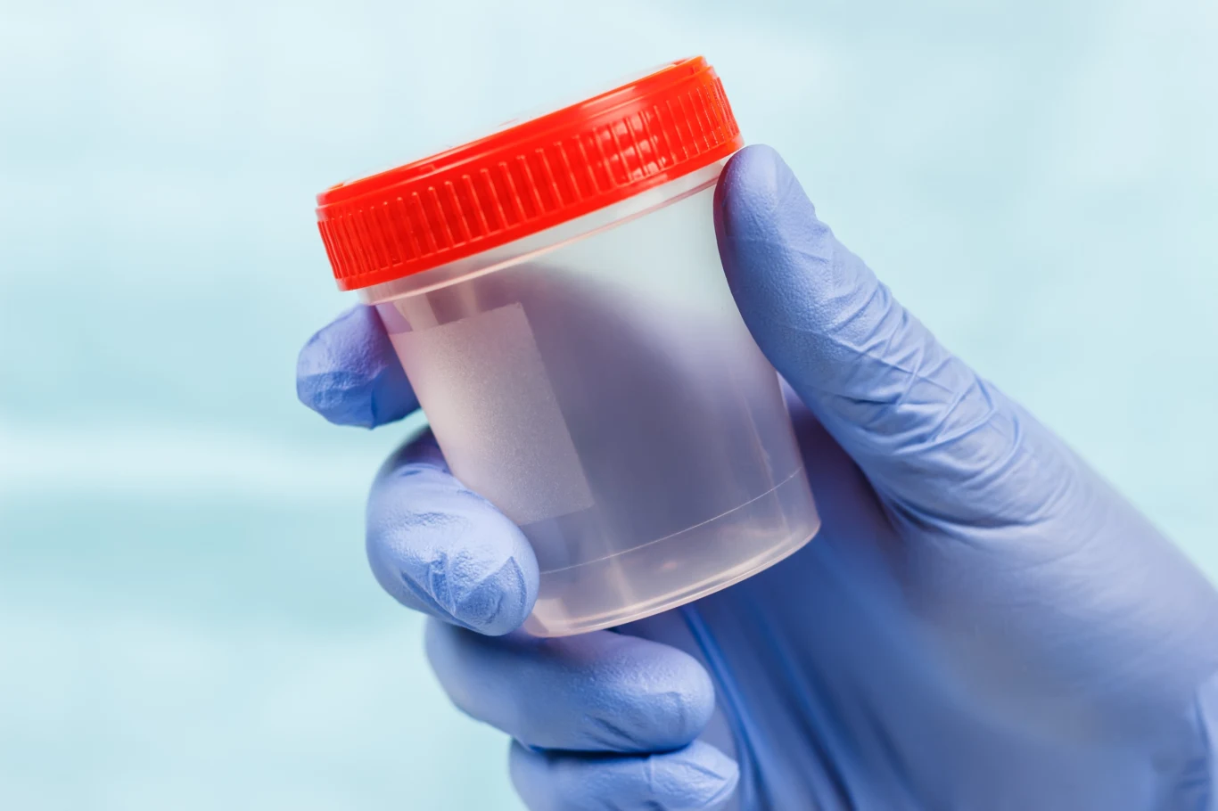 Białkomocz może świadczyć o problemach z nerkami albo z sercem Białkomocz może świadczyć o problemach z nerkami albo z sercem