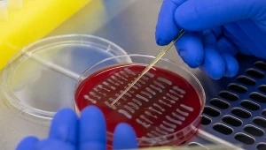 Walka z bakterią E. coli. Naukowcy na tropie rozwiązania