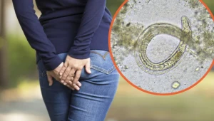 W ludzkim ciele żyją nawet dwa lata. Tymi sposobami możesz się ich pozbyć